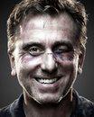 Tim Roth