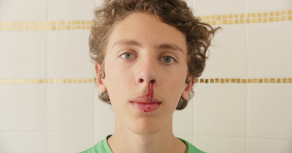 Chienne de rouge - © Shellac Chienne de rouge - © Shellac