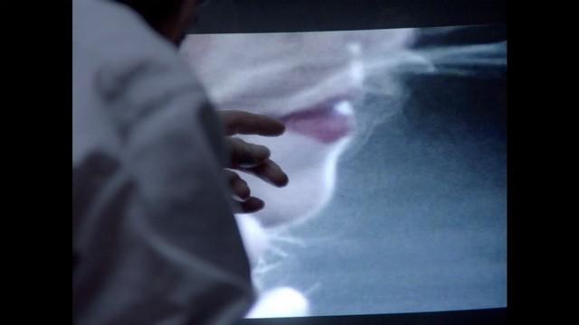 Les Yeux verts Les Yeux verts