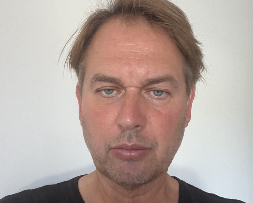 Franck Benzoni