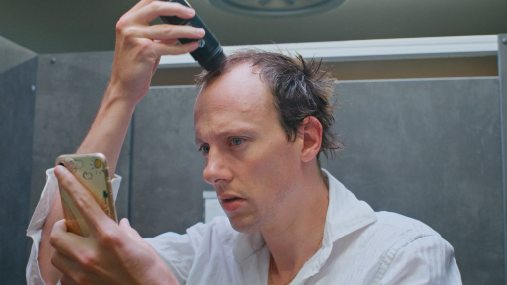 Receding Hairline Receding Hairline