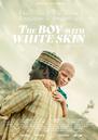The Boy With White Skin