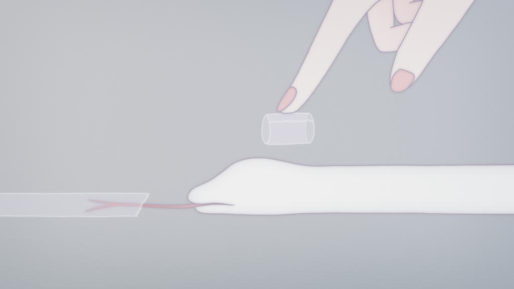 Anxious Body Anxious Body