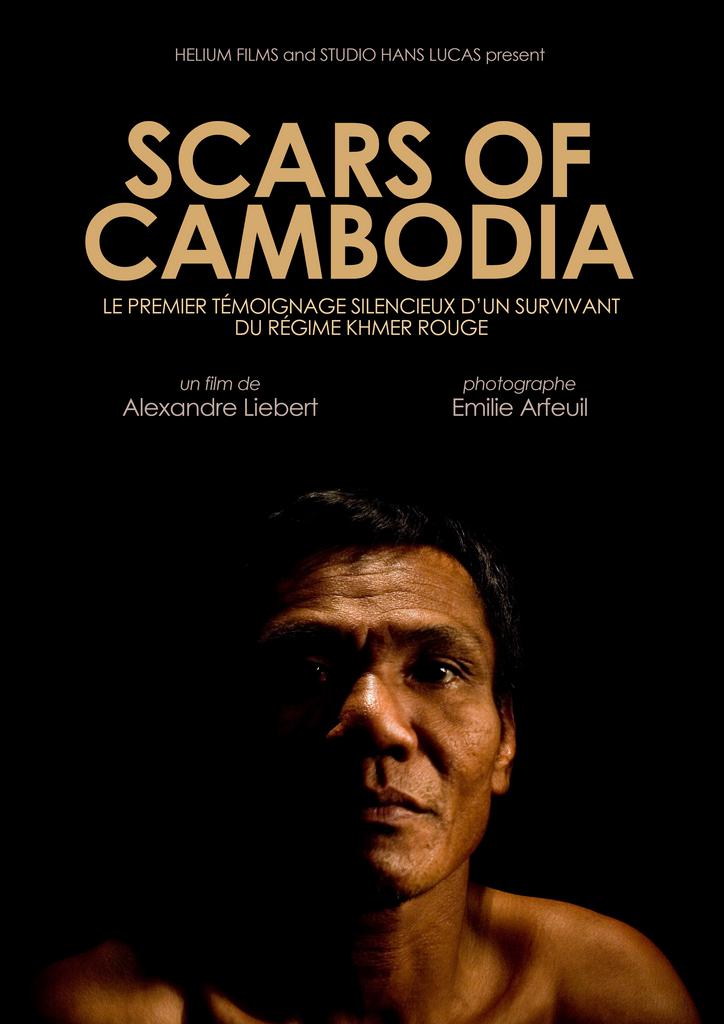 Scars of Cambodia Scars of Cambodia
