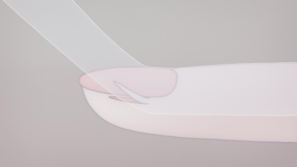 Anxious Body Anxious Body